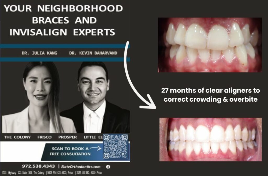 Close-up of ideal tooth positioning in a healthy bite with straight teeth and balanced jaw alignment.