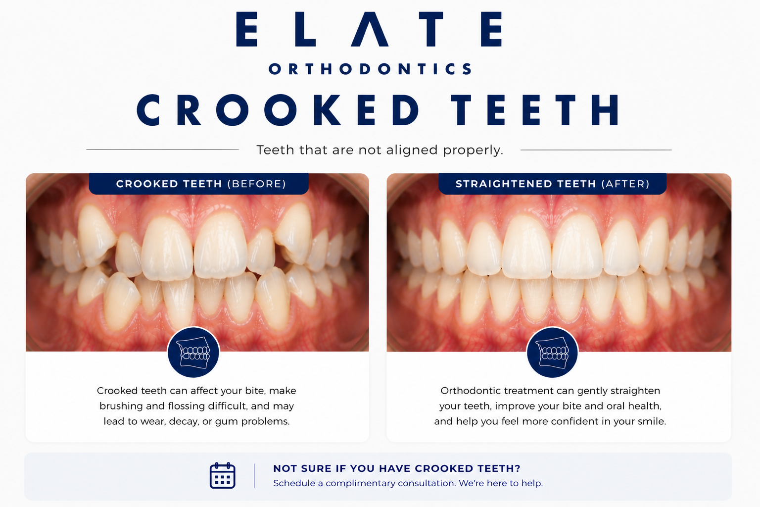 Crooked teeth correction at Elate Orthodontics in Frisco and The Colony TX with braces and clear aligners
