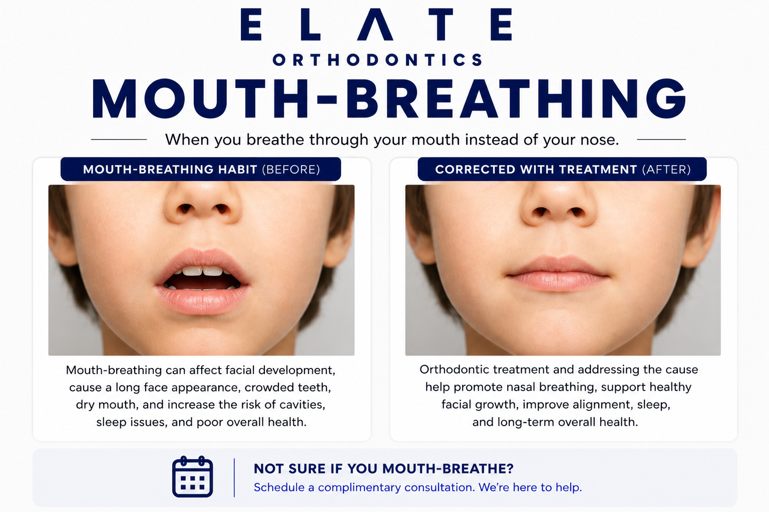 Mouth breathing correction at Elate Orthodontics in Frisco and The Colony TX with palatal expansion ENT coordination and myofunctional therapy